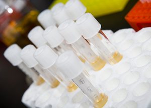 Test tubes await experimentation and further study in an ECU lab.