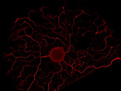 The microscope image above shows a sensory neuron from an animal that developed pain after spinal cord injury. (Photo courtesy of Sonja Bareiss)