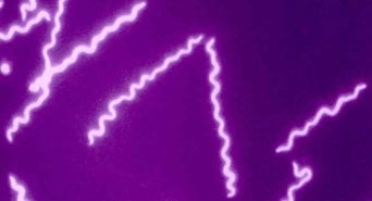 Borrelia burgdorferi, the causative agent of Lyme disease. The parasite resides in ticks and mammals. Actual size is 10-20 micrometer. Image courtesy Dr. Md Motaleb