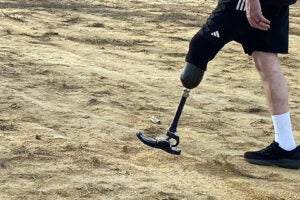 A person with a prosthetic foot and leg walks on dirt.
